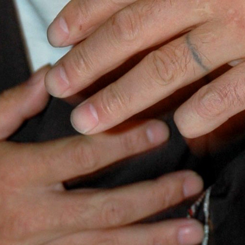 A gang member in Tokyo shows his means of atonement