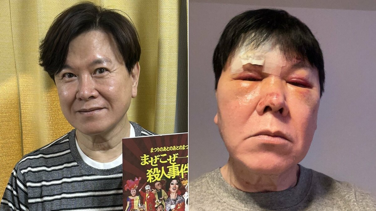 Yuji Mitsuya suffered severe accidents whereas drunk – TokyoReporter