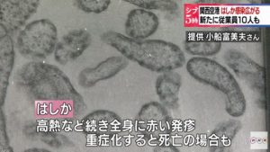 Officials in Amagasaki City, Hyogo Prefecture have confirmed 7 more cases of measles